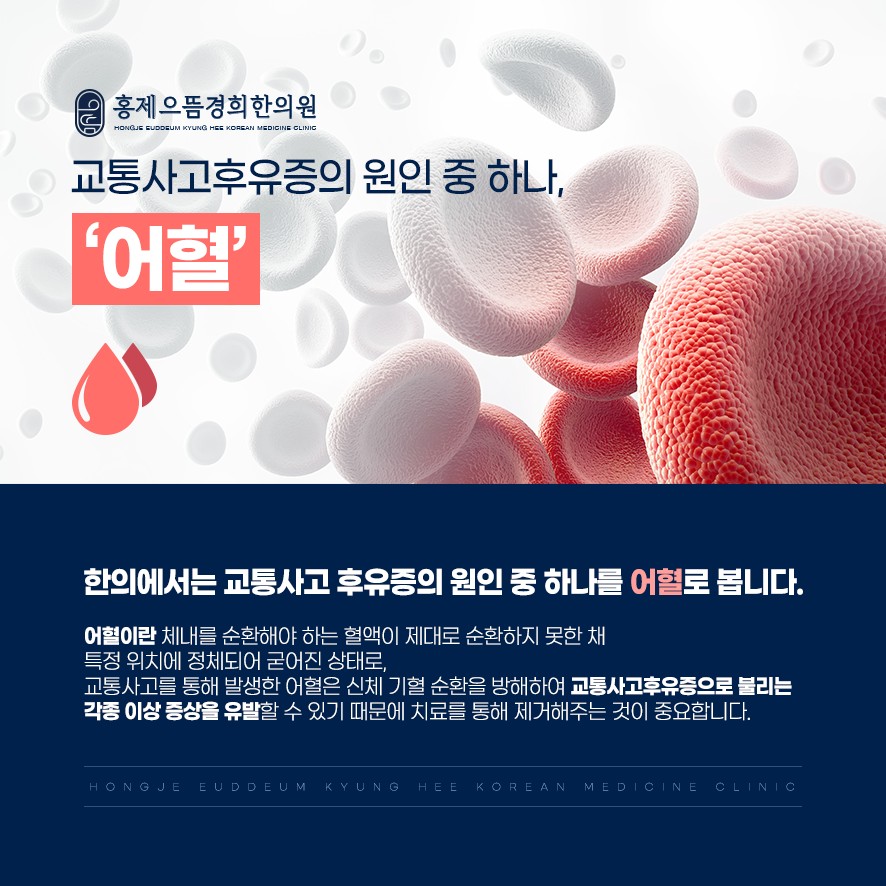 후유증의 원인 어혈에 대한 설명-체내를 순환해야 하는 혈액이 제대로 순환하지 못해 굳어진 것