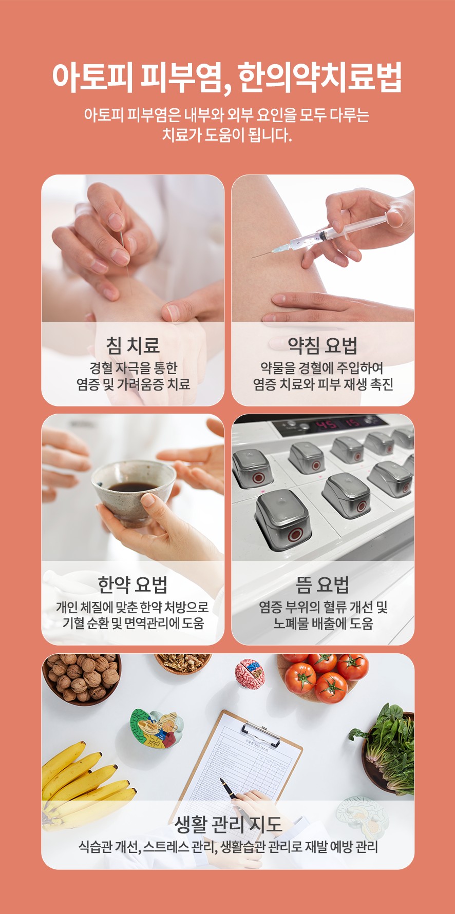 아토피 피부염의 한의약 치료(침,약침,한약,뜸)