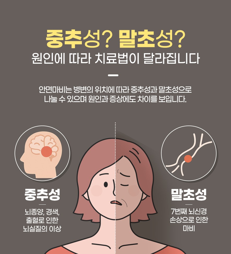 중추성과 말초성 유형과 원인에 따라 달라지는 안면마비의 치료